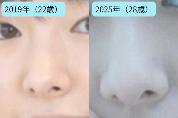 【画像比較】唐田えりかは整形してる？目・鼻の整形疑惑を徹底検証！ | ただひまch